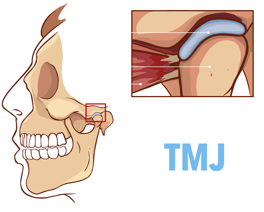 temporomandibular joint disorder treatment  TMJ & TMD Doctor in Albany, NY | W. Daniel Billington, DMD, MS, FAAOP, PLLC